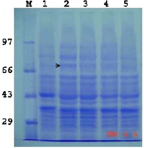 Analysis Of Outer Membrane Protein Preparations Following Iron Stress