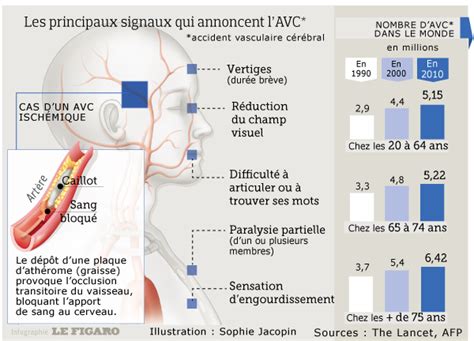 Accident vasculaire cérébral AVC Qu est ce que c est Fiches