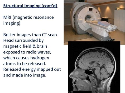 Types Of Brain Imaging Techniques Microelectrode Examines