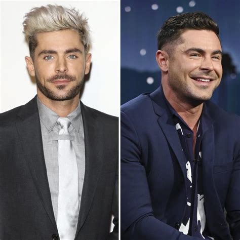 ¿fue Cirugía Zac Efron Rompe El Silencio Sobre La Transformación De Su