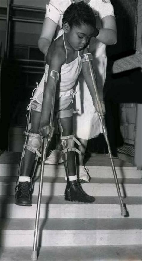 Pin By Dianne Dych On Polio 3 Polio Leg Braces Braces