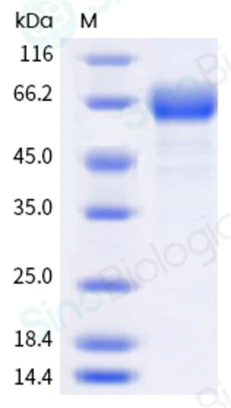 Sino Biological Human CD19 Protein Fc Tag 1mg Quantity Each Of 1