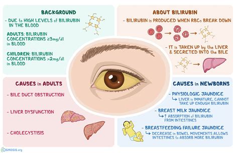 Scleral Icterus Medizzy