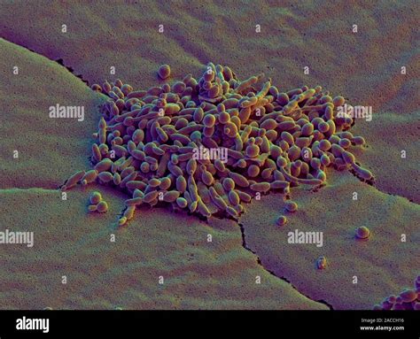 Yeast Cells Coloured Scanning Electron Micrograph Sem Of A Colony Of