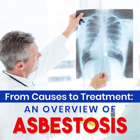 From Causes To Treatment An Overview Of Asbestosis Blog Aware