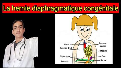 La Hernie Diaphragmatique Cong Nitale Youtube