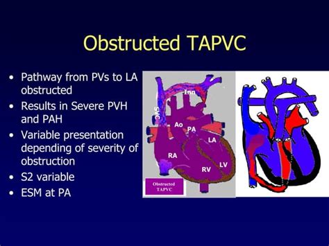 Approach To Cyanotic Congenital Heart Disease Ppt