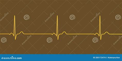 Electrocardiogram Ecg Displaying Sinus Bradycardia D Illustration