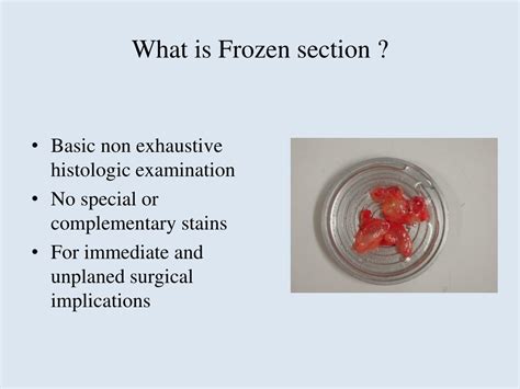 Ppt Frozen Section Powerpoint Presentation Free Download Id8970336