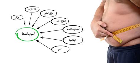 اسباب السمنة كيفيه علاج مرض السمنه المفرطه دلع ورد