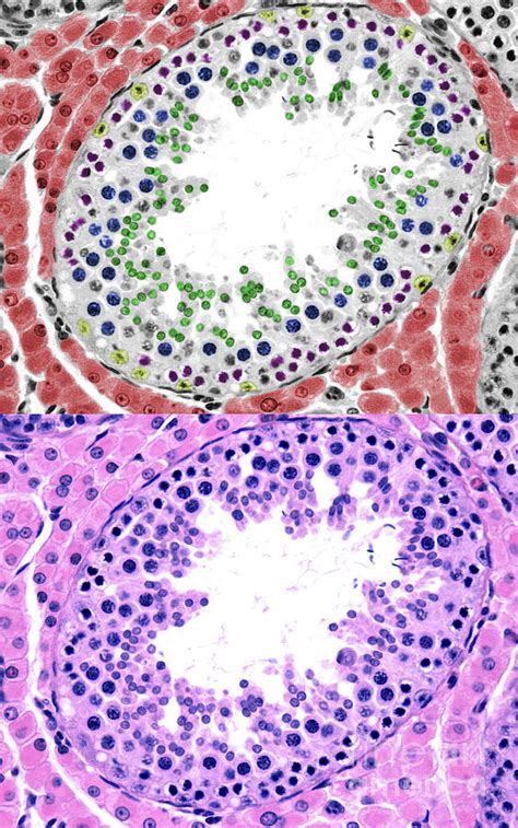 Seminiferous Tubules And Leydig Cells By Jose Calvo Science Photo Library