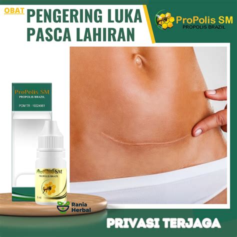 Jual Obat Pengering Luka Pasca Lahiran Caesar Obat Penyembuhan Luka