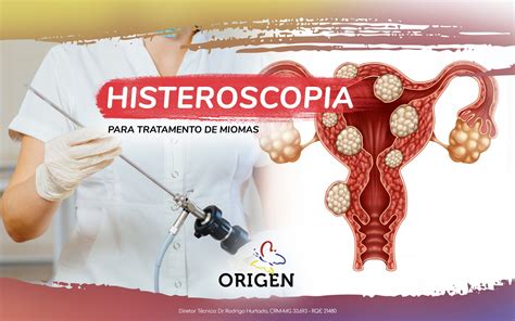 Histeroscopia para tratamento de miomas Clínica Origen Fertilização