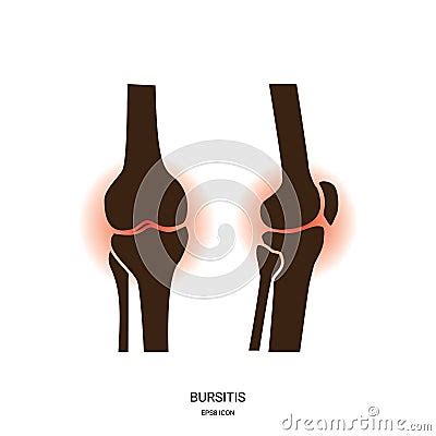 Bursitis And Knee Joint Icon Cartoon Vector CartoonDealer 111175185