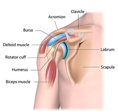 Shoulder Impingement treatment - Ace Health Centre