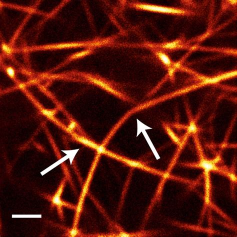 The Microstructure Of Actin Fascin Bundle Networks Indicates The