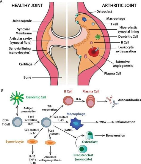 Role Of Cd4 T Cells In Rheumatoid Synovitis In Healthy And Arthritic Download Scientific