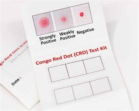 Congo Red Dot Paper Test For Antenatal Triage And Rapid Off