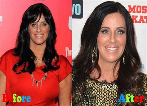 Patti Stanger Plastic Surgery Before and After | | Plastic Surgery Magazine