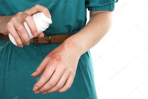 Treatment Of Burns By Spray On Female Hand Isolated On White Stock