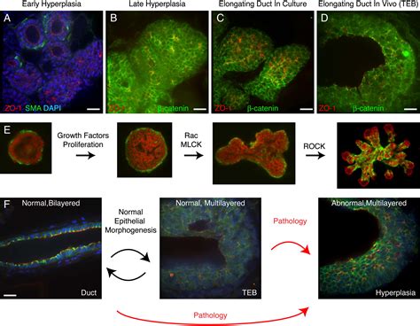 Collective Epithelial Migration And Cell Rearrangements Drive Mammary