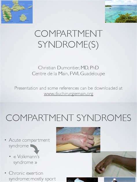 Compartment Syndrome Hand and Forearm | PDF | Diseases And Disorders ...