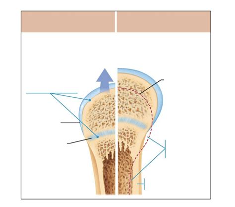 Chapter 6 Bones And Skeletal Tissue Lab Exam Pt 13 Diagram Quizlet