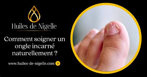 Soigner Un Ongle Incarn Naturellement Le Guide Pratique En