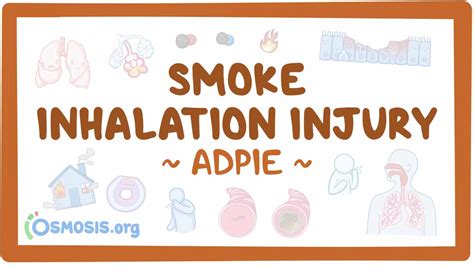 Smoke inhalation injury: Nursing process (ADPIE): Video, Causes ...