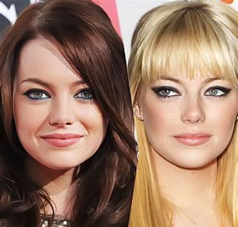 Emma Stone Before And After Plastic Surgery Celebrity Plastic