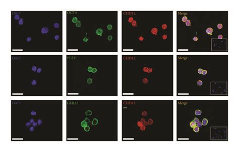 Chd1l Is Expressed In Thy1⁺ Sscs Immunofluorescence Staining Assays