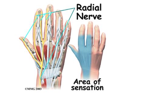 Compressie Nervus Radialis Dr Kuypers Kliniek Hoorn Hand En