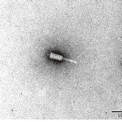 Morphology Of The Phage Vb Vps Pg Under Transmission Electron Microscopy