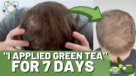 Benefits Of Green Tea To The Hair Health Benefits