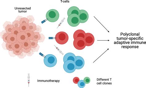 Frontiers Preoperative Immunotherapy In The Multidisciplinary