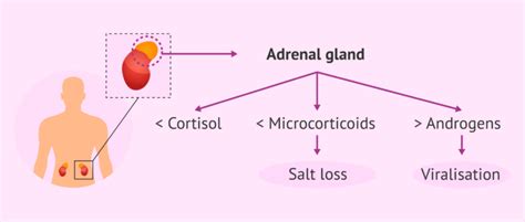 Pathophysiology Of Congenital Adrenal Hyperplasia