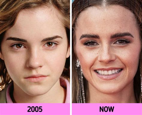 11 Celeb Close Ups That Show How Their Faces Have Changed Over The