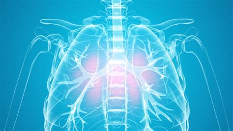 Understanding Interstitial Lung Disease: A Comprehensive Guide - Namdrc