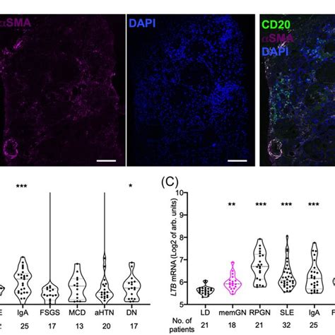 Lymphoid Structures And Expression Of Its Organizers CXCL13 And LTB Are