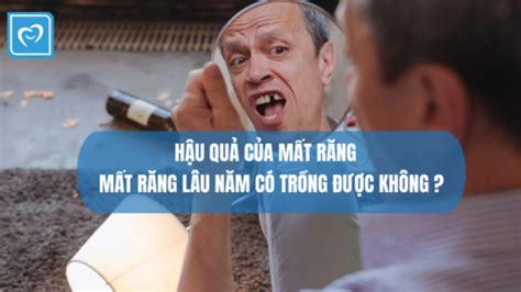 Hậu quả của mất răng là gì Mất răng lâu năm có trồng được không