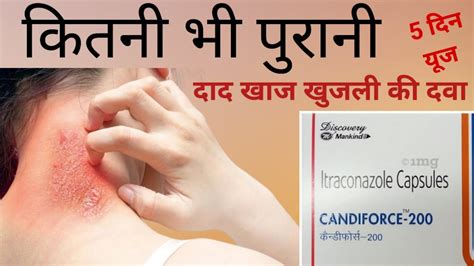 Candiforce In Hindi Candiforce Mg Capsule