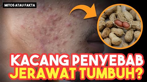 Banyak Makan Kacang Bisa Menumbuhkan Jerawat Mitos Atau Fakta Youtube