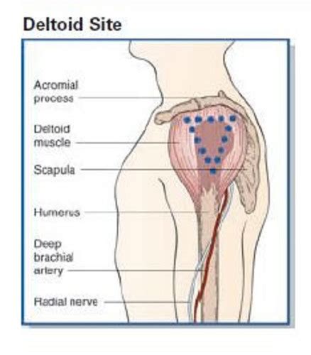 Injection sites Flashcards | Quizlet