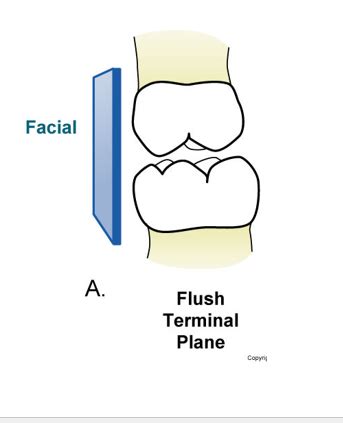 Ortho Exam 2 Wire Bending For Traumatic Injuries And Interceptive