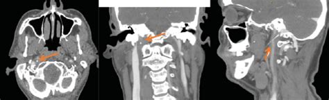 Preoperative Computed Tomography Ct Imaging Download Scientific