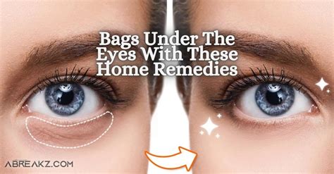 Get Rid Of Dark Circles And Bags Under The Eyes With These Home Remedies