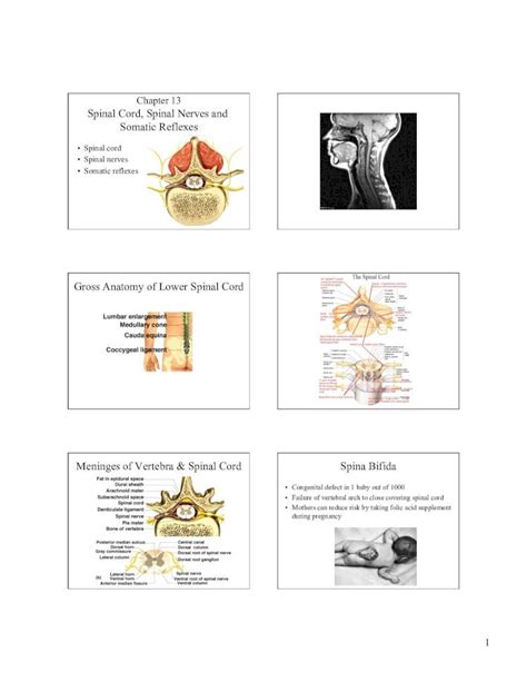 PDF 9 Chapter 13 Spinal Cord PDF FileChapter 13 Spinal Cord