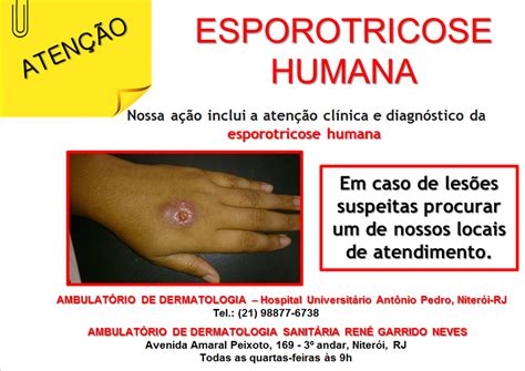 Esporotricose Fernando Bragan A Pediatria E Homeopatia