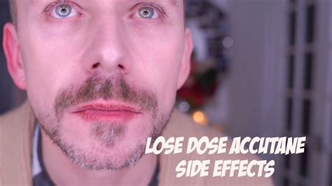 I Started Taking Low Dose Accutane Youtube