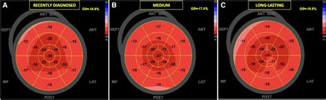 The Examples Of Global Longitudinal Strain In HH Patients At Different